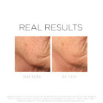 Bio-Shape Mask - Image 3